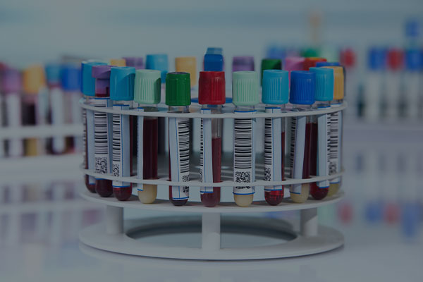 Merkez Organizasyon Yönetimi (SMO)